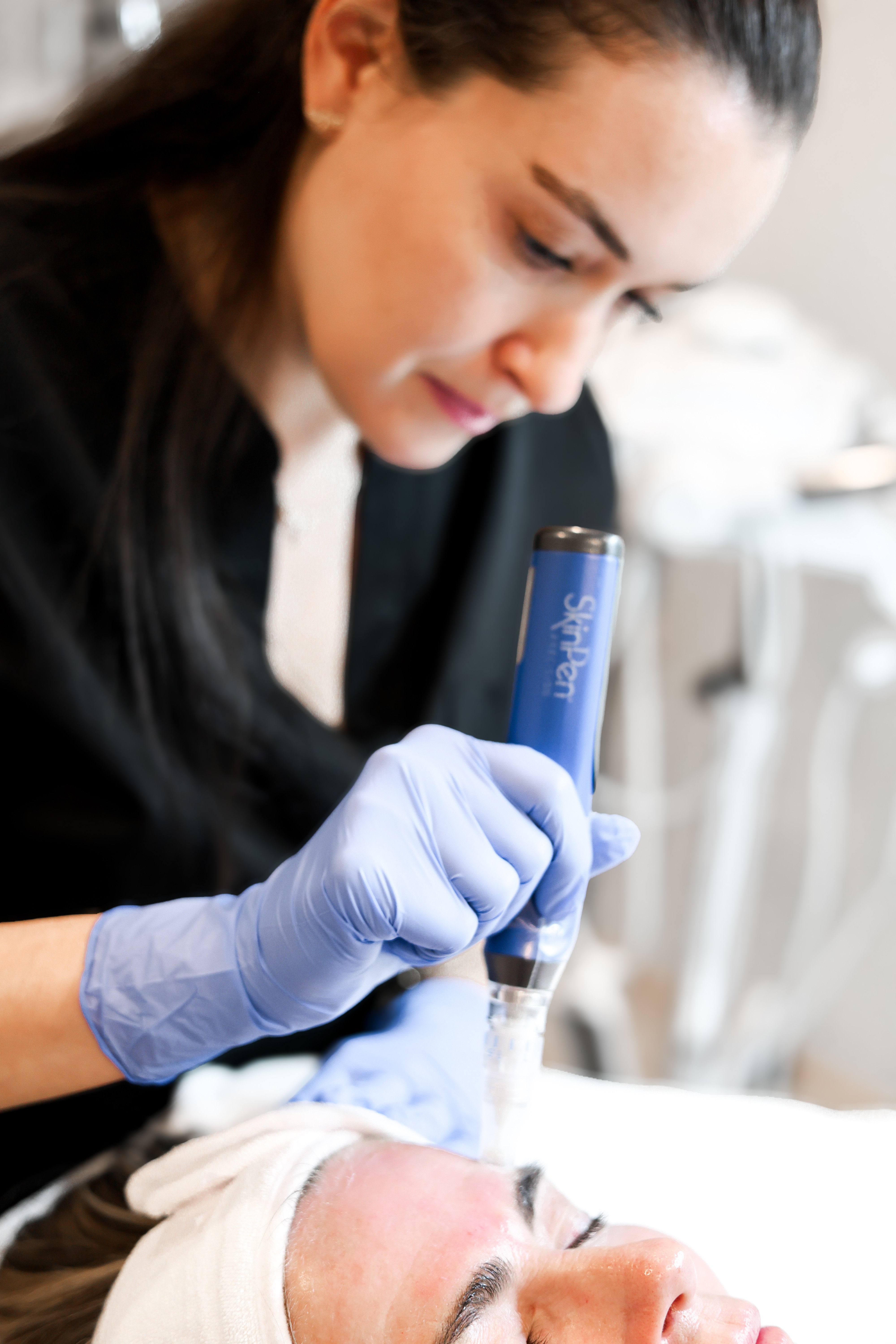 Microneedling skin rejuvenation results